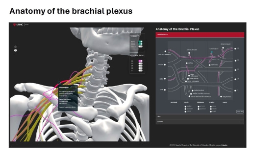 Anatomy_of_the_Brachial_Plexus.jpg