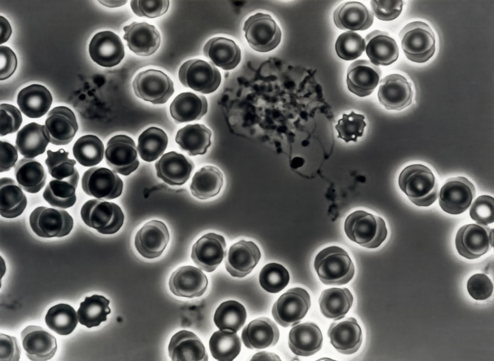 Phase contrast microscopy of live human blood passing through a cardiac hypothermia pump showing crenellation and fibrin formation.